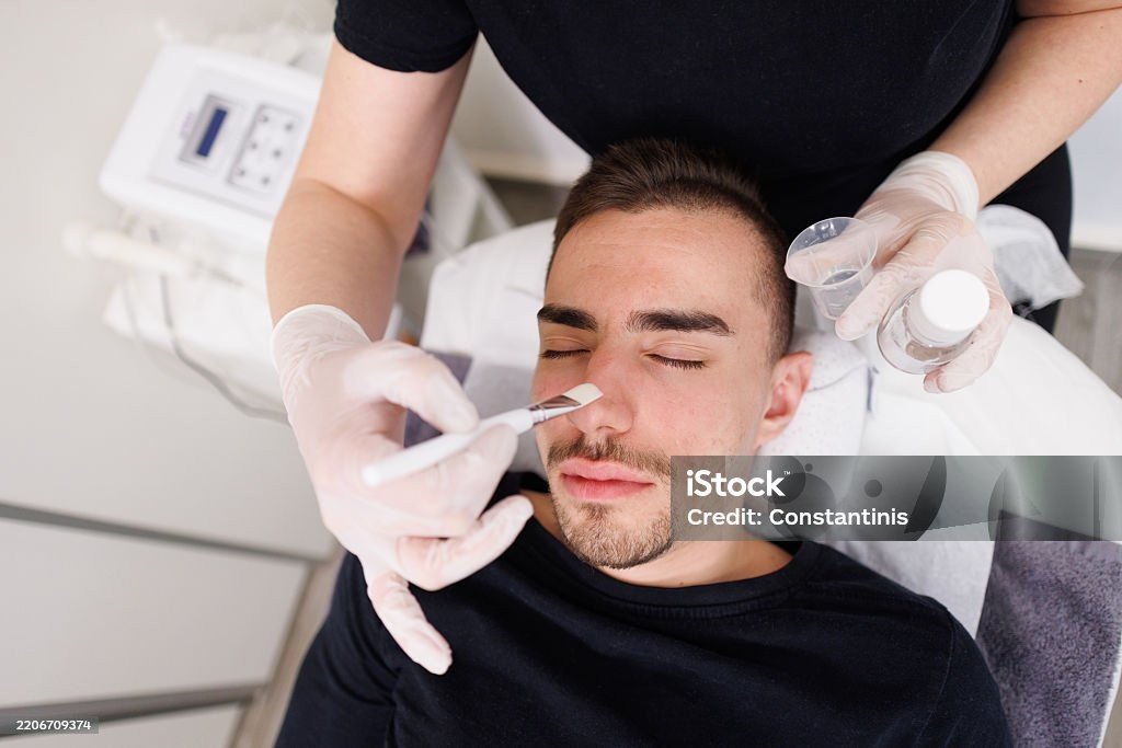 Peeling Químico