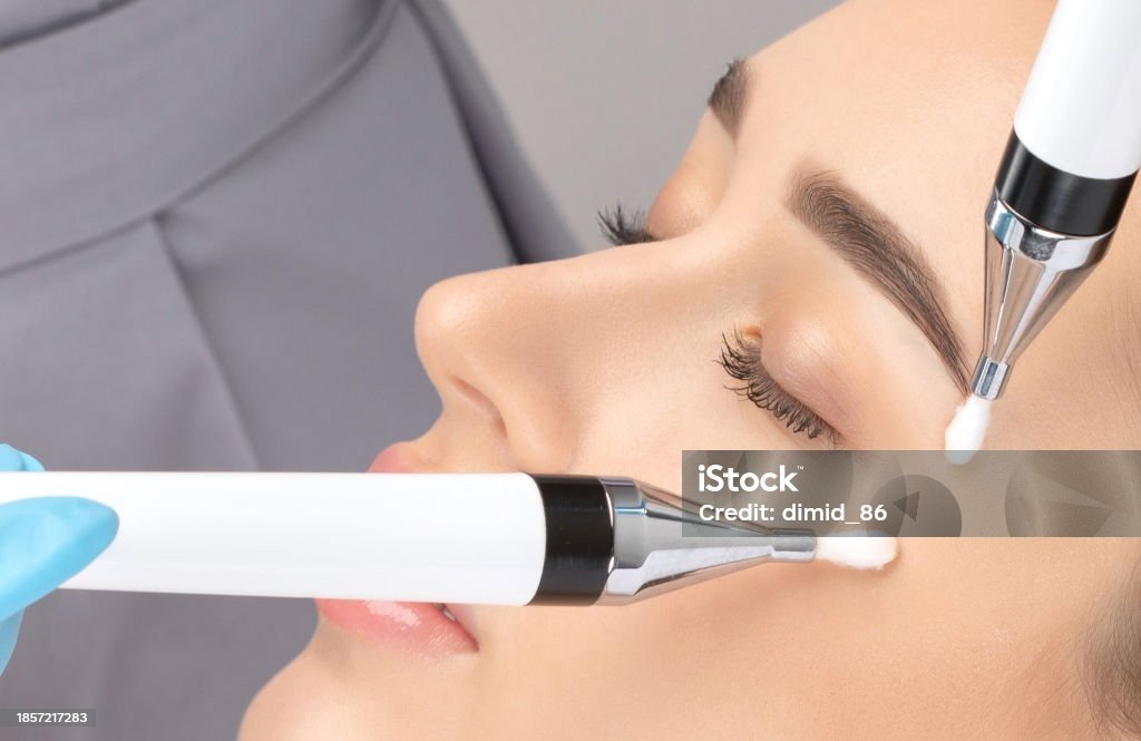 Microdermoabrasión