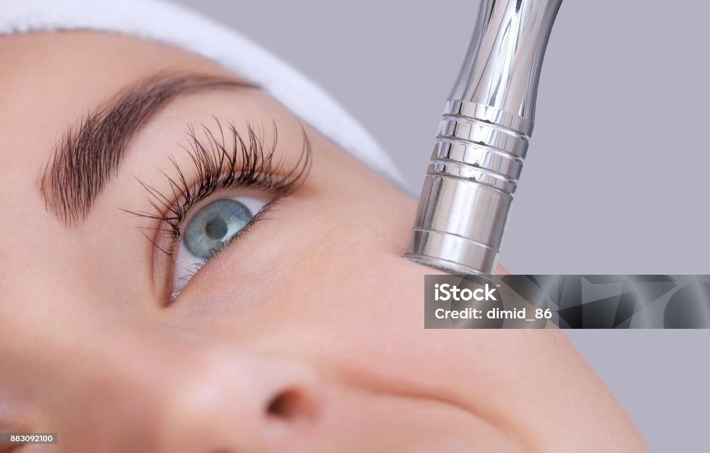 Microdermoabrasión
